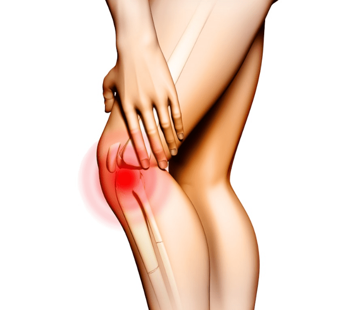 Stades d'arthrose