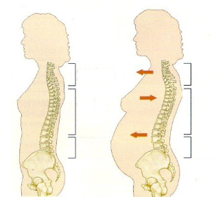 Ostéochondrose pendant la grossesse